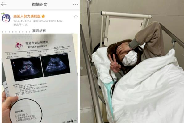 网红顾茜茜直言自己下午睡觉被疼醒，原因竟是诊断得了双肾结石！