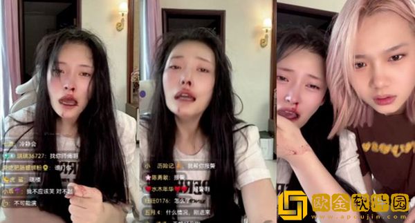 快手网红大琳被家暴之后首发声，鼻子手术已做完！