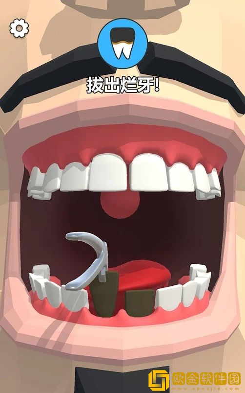 拔牙吗我贼6